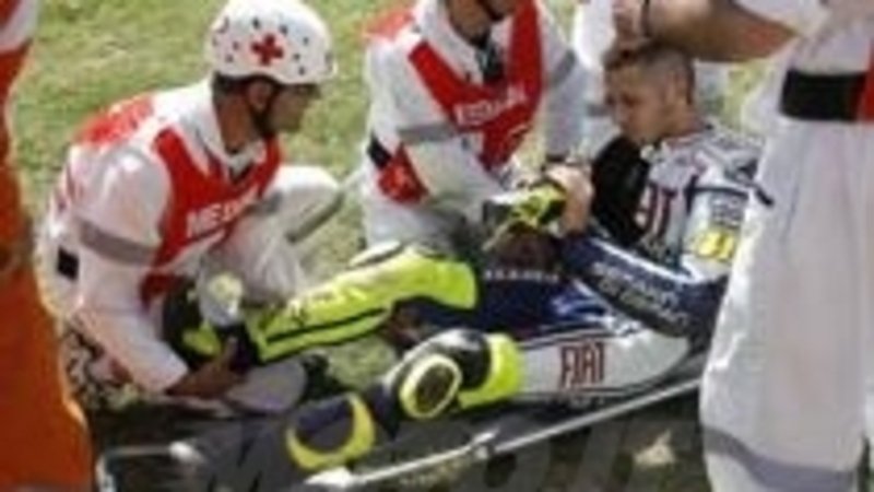 Rossi cade, frattura scomposta ed esposta di tibia e perone