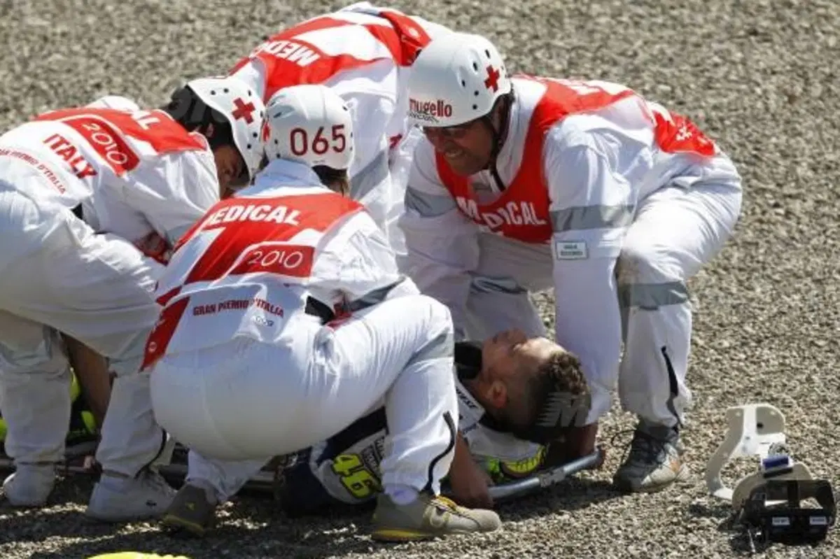 Rossi cade, frattura scomposta ed esposta di tibia e perone (6)
