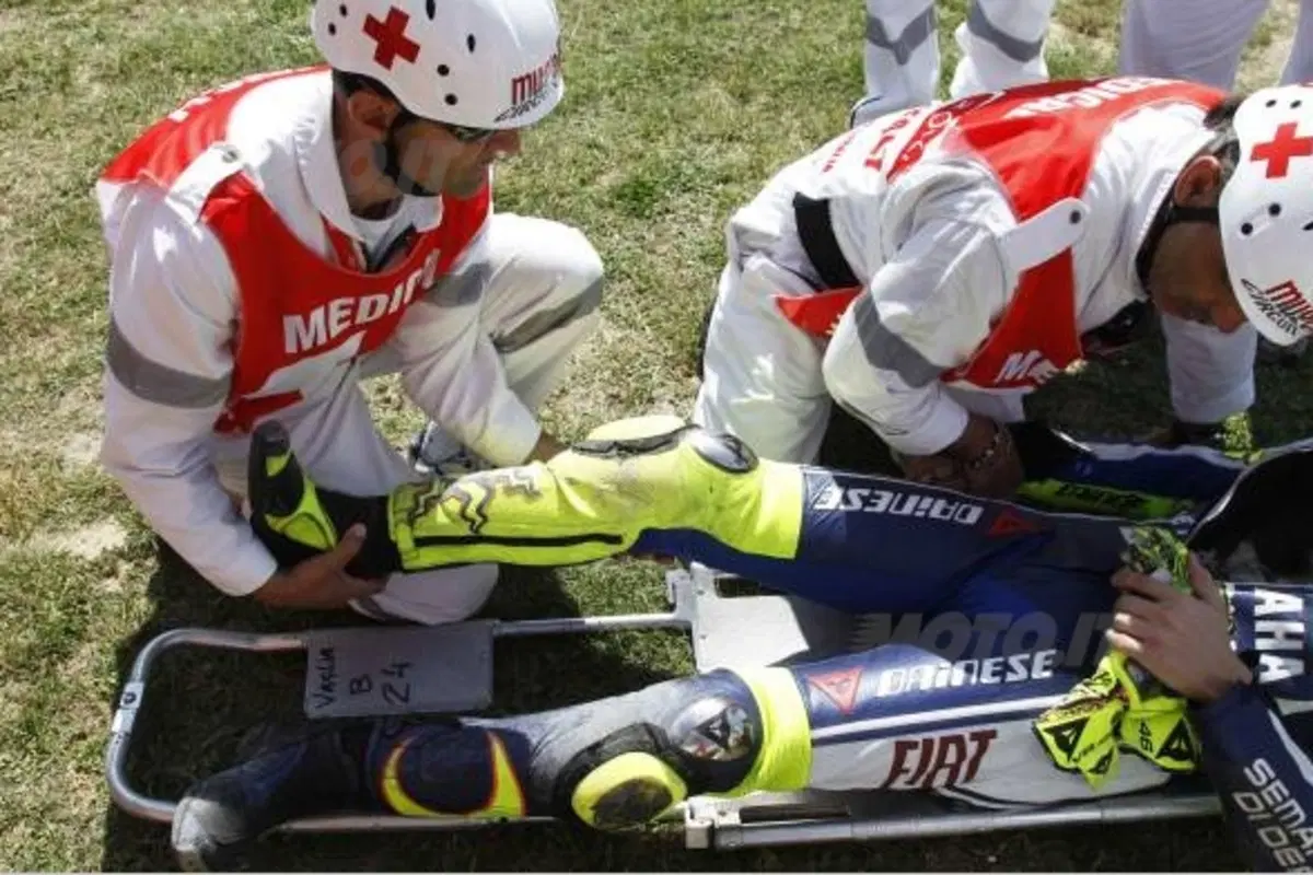 Rossi cade, frattura scomposta ed esposta di tibia e perone (9)