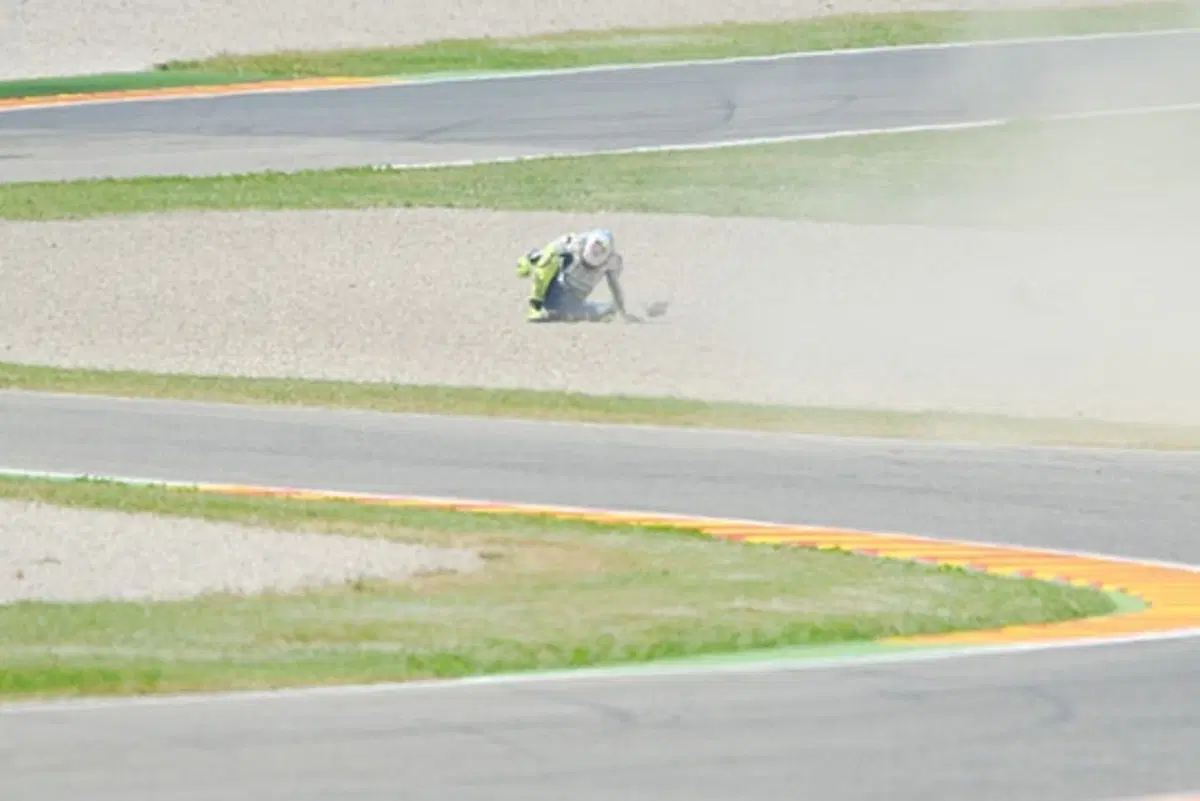 Valentino Rossi. Il secondo intervento alla gamba è andato bene (5)