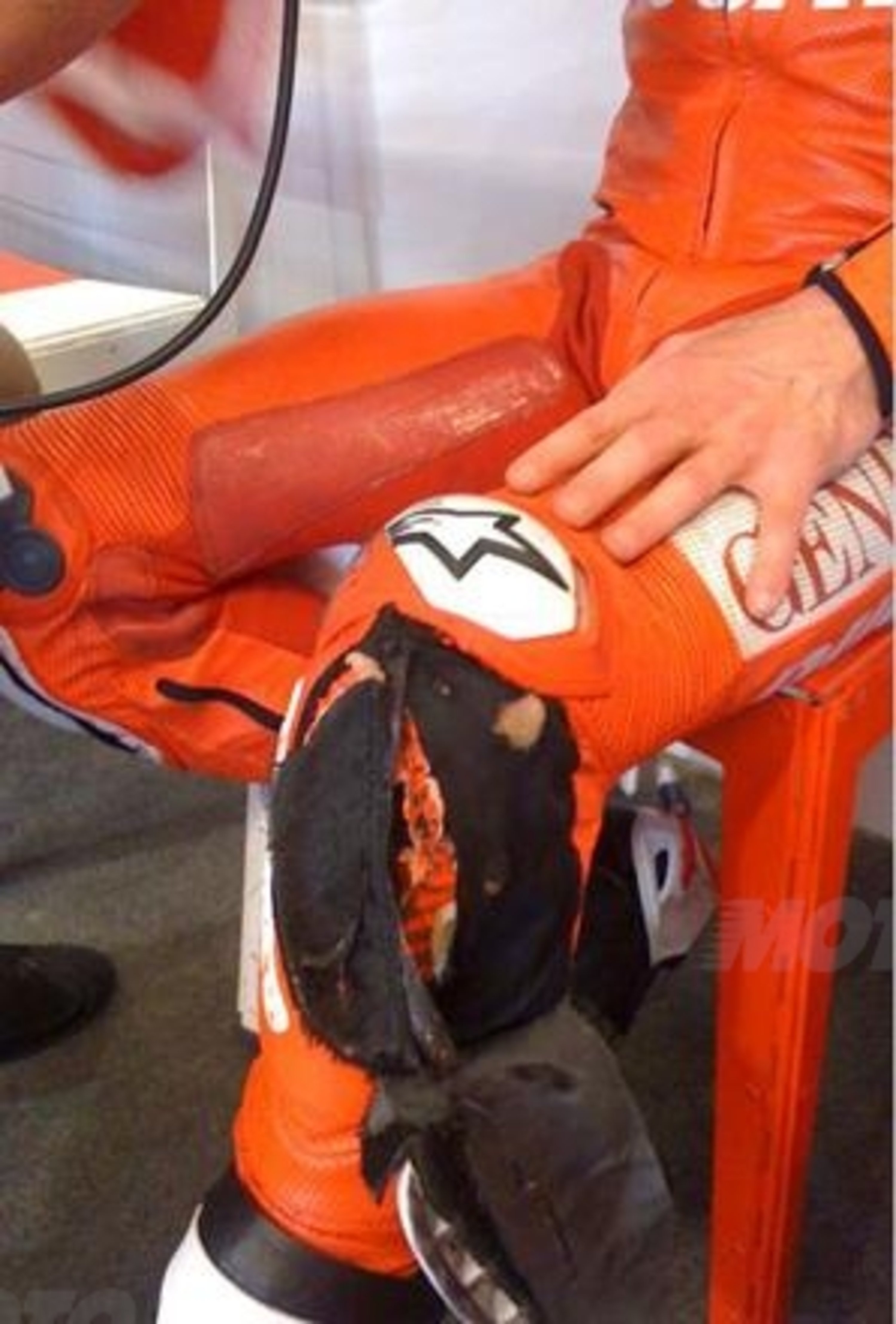 Il ginocchio di Nicky Hayden dopo il GP d&#039;Indianapolis