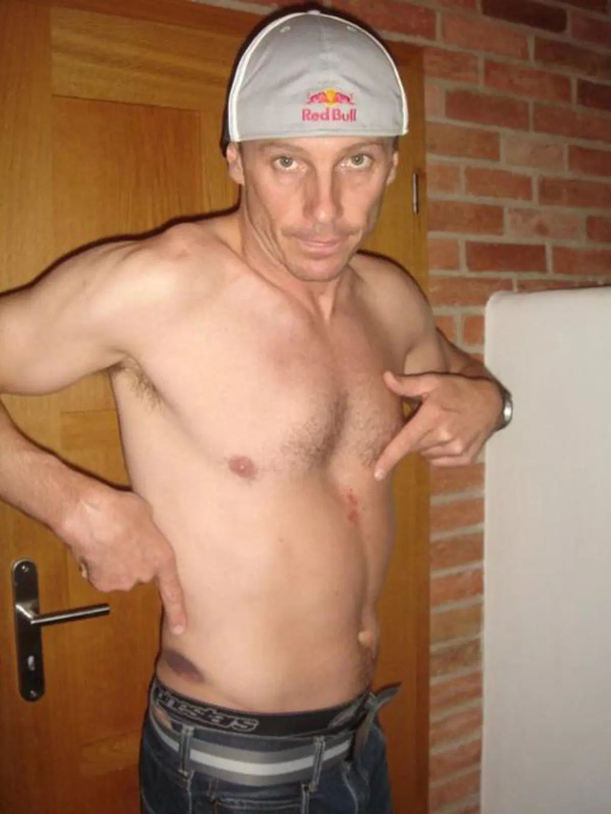 Chris Pfeiffer si è infortunato a Colonia (2)