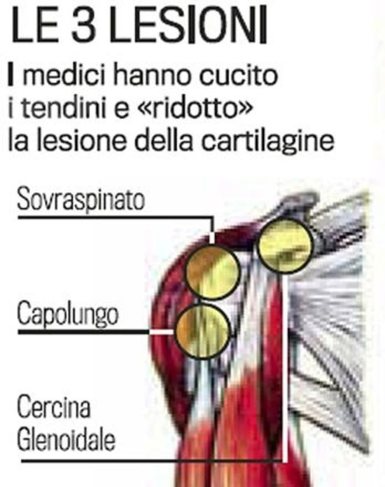 Effettuata con successo l'operazione alla spalla di Valentino Rossi