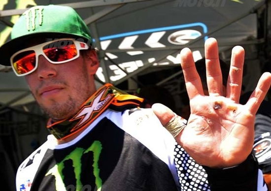 Steven Frossard: più forte del dolore