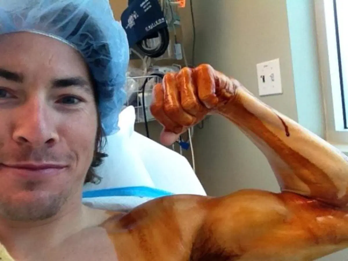 Operazione alla spalla per Nicky Hayden (2)