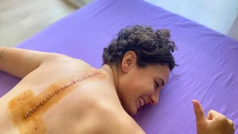 SSP300. Ana Carrasco mostra la cicatrice: "Ci&ograve; che non uccide, fortifica!"