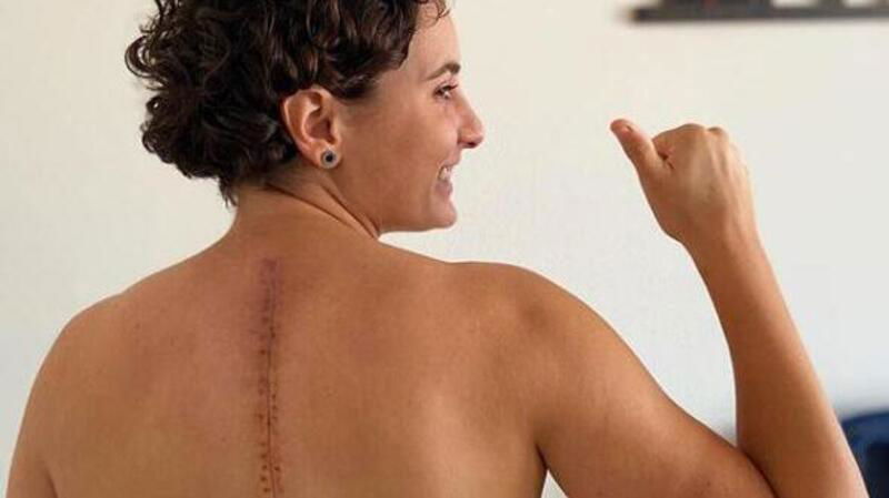 Ana Carrasco condivide la foto della sua cicatrice: &quot;Sempre meglio!&quot;