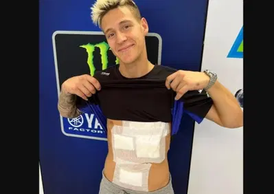 MotoGP 2022. GP di Aragon. La giornata nera di Quartararo: bruciature, zero punti e anche un incidente in scooter