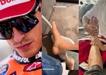 MotoGP 2023. Come sta Marc Marquez? Caviglia gonfissima, fisioterapia, Assen a rischio