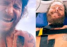 [VIDEO] Jovanotti si è rotto clavicola e femore cadendo dalla bicicletta. Ora è ricoverato in ospedale a Santo Domingo