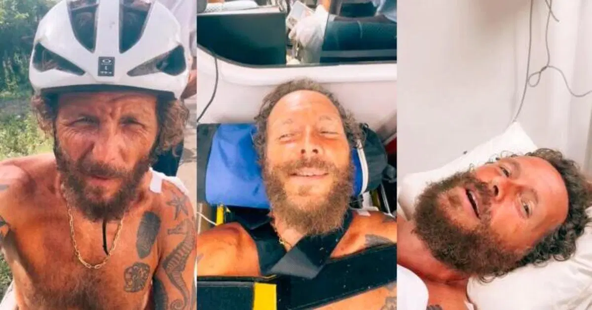 Jovanotti, dopo l'incidente in bici i medici hanno sbagliato l'operazione: "Ho una gamba pi&ugrave; corta". Ecco cos'&egrave; andato storto