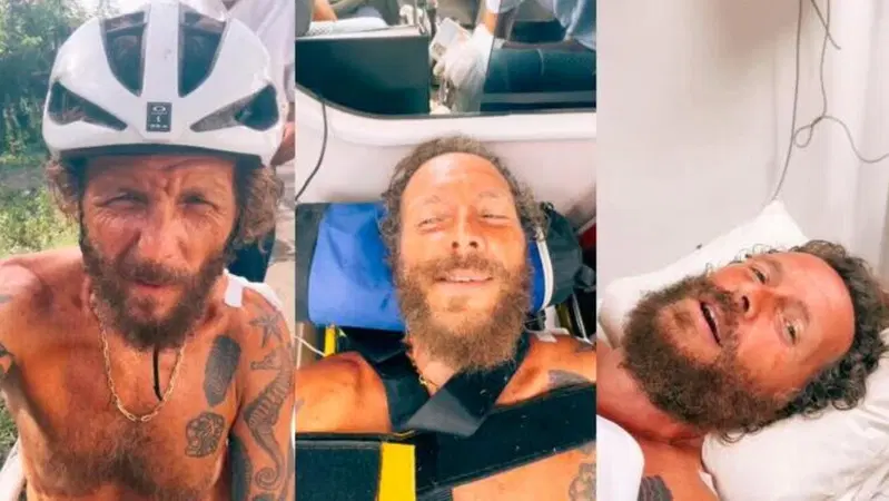 Jovanotti, dopo l'incidente in bici i medici hanno sbagliato l'operazione: "Ho una gamba pi&ugrave; corta". Ecco cos'&egrave; andato storto