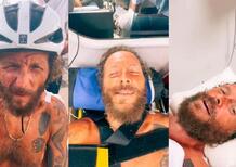 Jovanotti, dopo l'incidente in bici i medici hanno sbagliato l'operazione: Ho una gamba più corta. Ecco cos'è andato storto