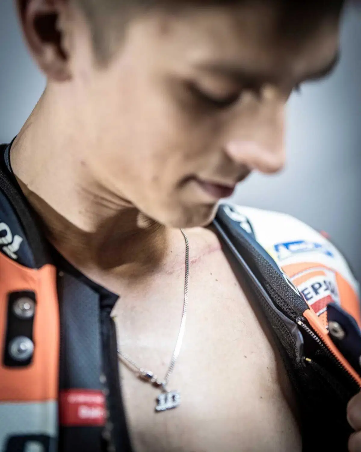 MotoGP 2024. I corpi dei piloti sono pieni di cicatrici: guardate qua! [GALLERY] (11)