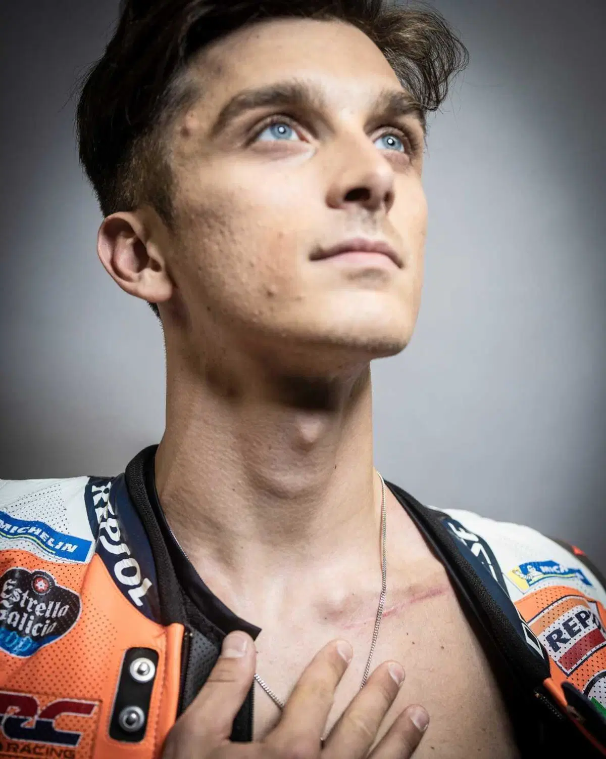 MotoGP 2024. I corpi dei piloti sono pieni di cicatrici: guardate qua! [GALLERY] (14)