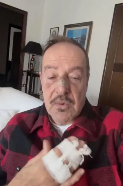 L'attore Massimo Lopez investito da un pirata della strada