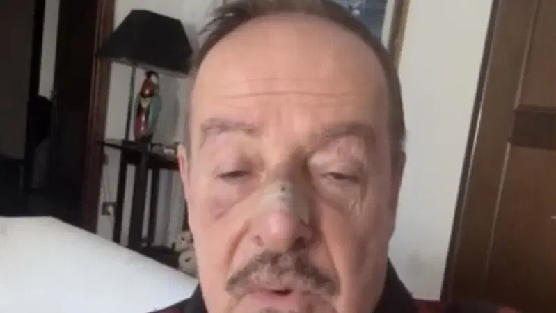 L'attore Massimo Lopez investito da un pirata della strada