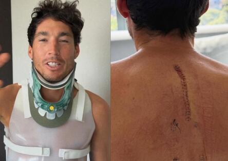 Le prime parole di Aleix Espargaro dopo l'incidente: Finalmente sono in piedi [VIDEO]