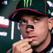 MotoGP 2026. GP di Germania. Marco Bezzecchi dopo l'operazione alla clavicola: Sono tornato ai box sul sellino di uno scooter e già sapevo che non andava