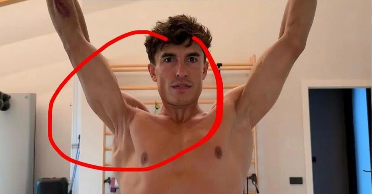 MotoGP 2026. Marc M&aacute;rquez ci ha mostrato com'&egrave; messa davvero la sua spalla destra, guardate anche voi