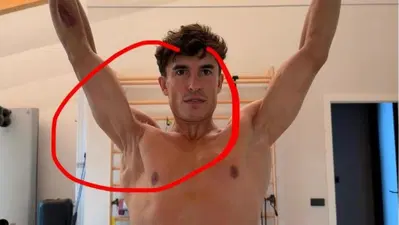 MotoGP 2026. Marc M&aacute;rquez ci ha mostrato com'&egrave; messa davvero la sua spalla destra, guardate anche voi
