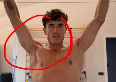 MotoGP 2026. Marc Márquez ci ha mostrato com'è messa davvero la sua spalla destra, guardate anche voi