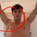 MotoGP 2026. Marc Márquez ci ha mostrato com'è messa davvero la sua spalla destra