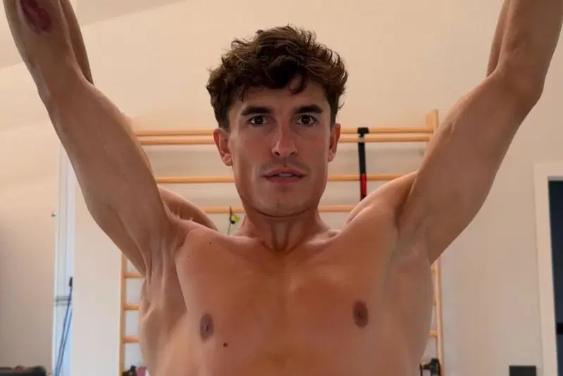 La condizione della spalla destra di Marc Marquez nella foto condivisa dal pilota sui social